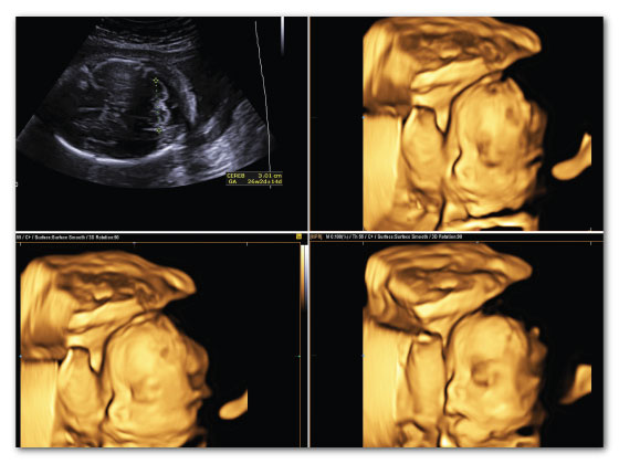 Scans and diagnostics in Habsiguda