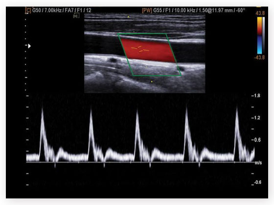 Scans and diagnostics in Habsiguda