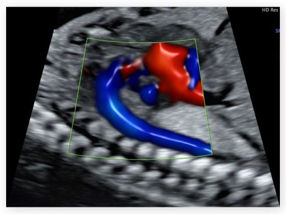 Scans and diagnostics in Habsiguda