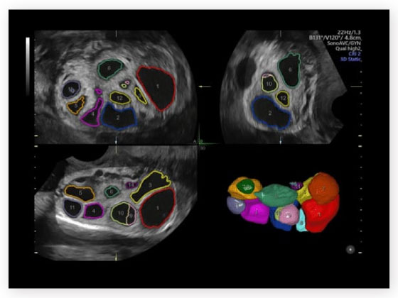  Scans and diagnostics in Habsiguda