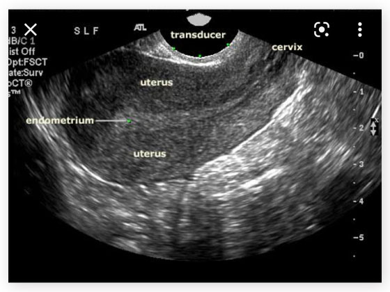  Scans and diagnostics in Habsiguda